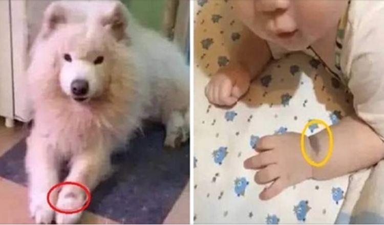 Žena uvjerava da je njezino dijete reinkarnacija njezina psa zbog madeža